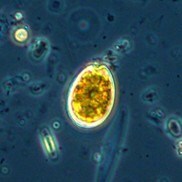 University Researchers Uncover Hidden Toxin Risks During Nutrient-Starved Algal Blooms